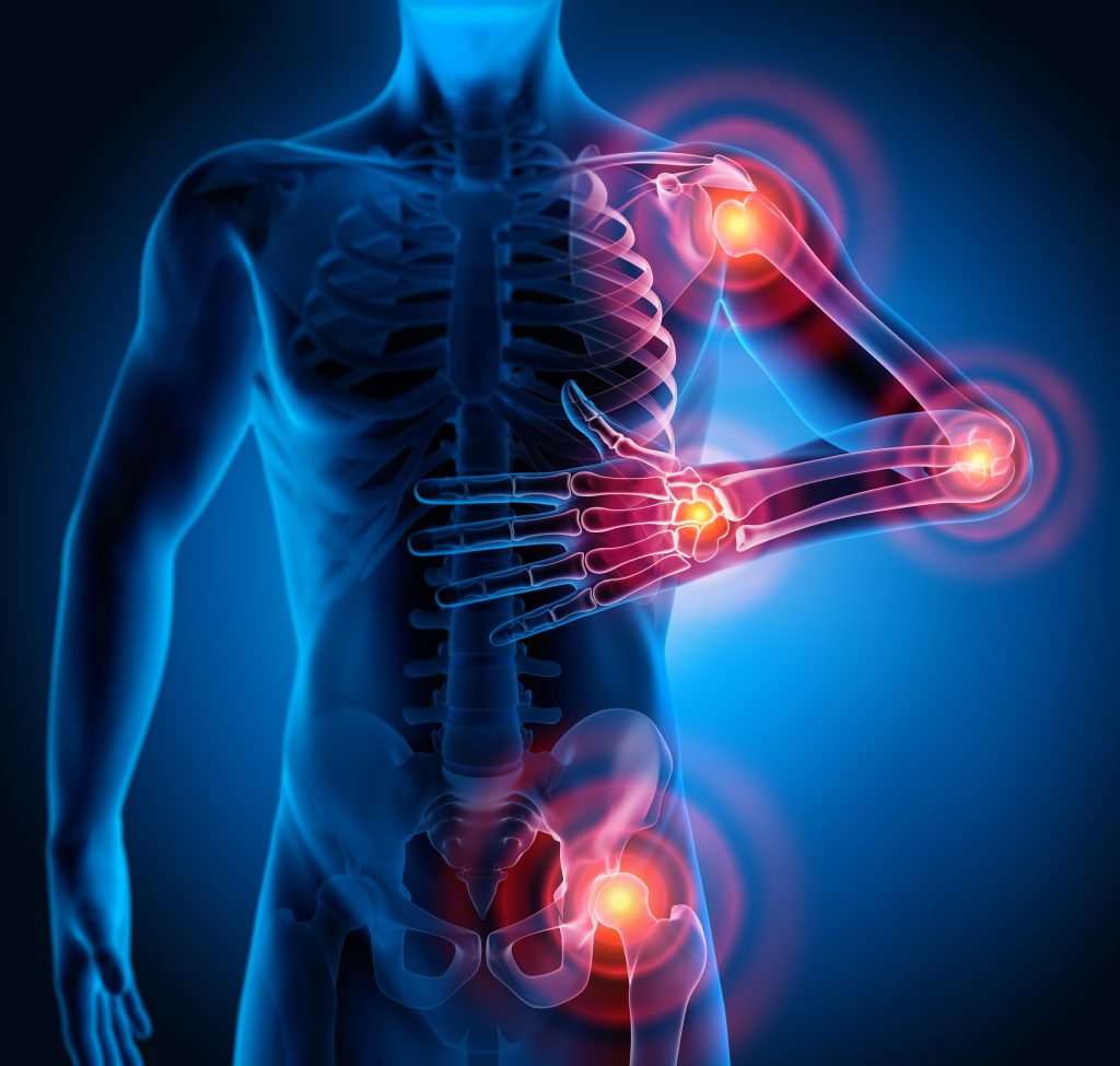 This image depicts a human skeletal system with a focus on joint pain or inflammation. The transparent body reveals the bones and internal structure, while several joints—specifically the shoulder, elbow, wrist, and hip are highlighted with glowing red and orange circles, indicating areas of pain or inflammation. The background is dark, emphasizing the illuminated areas of concern.