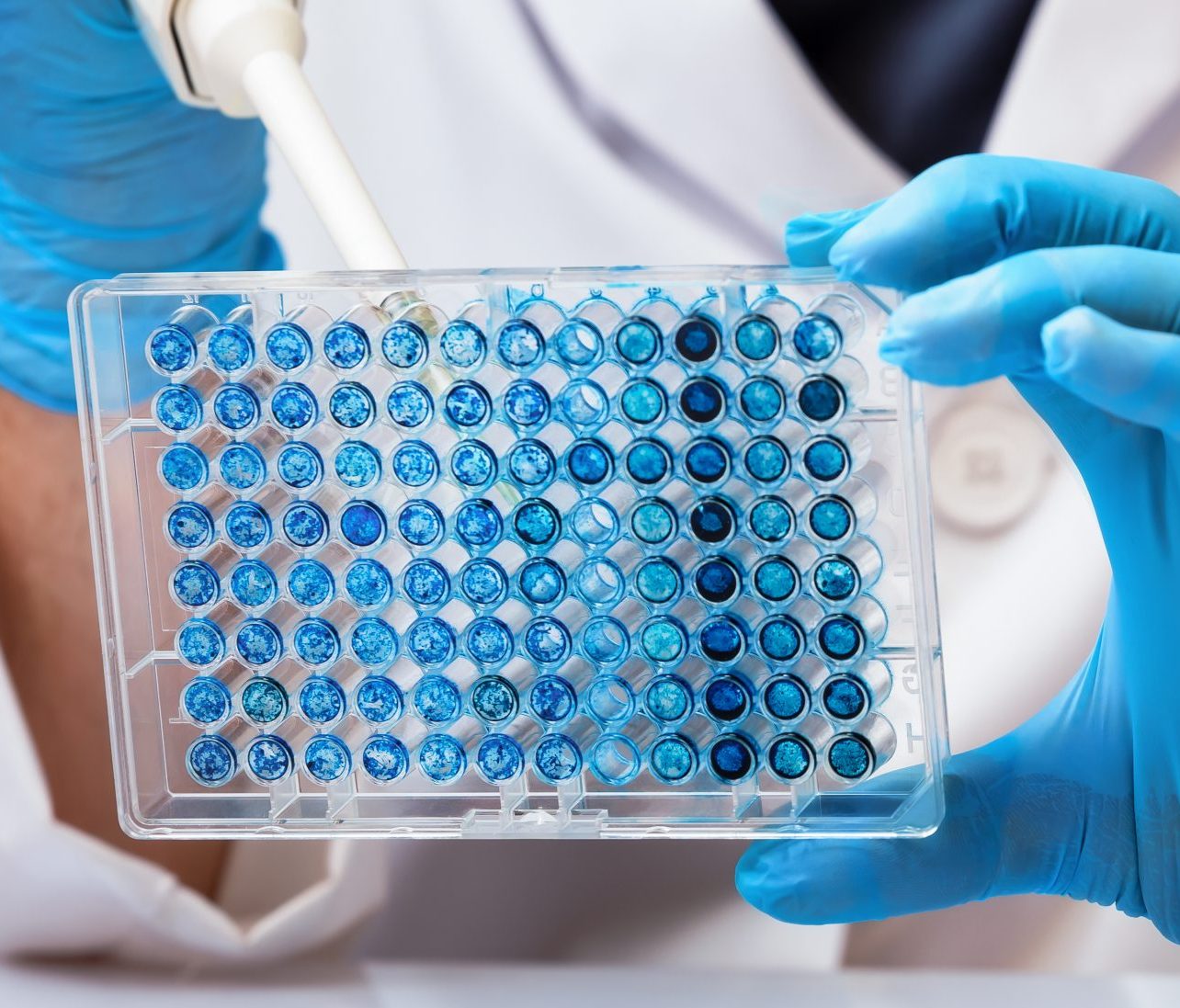 This is a close-up shot of a scientist or lab technician at work. The person, wearing a white lab coat and blue disposable gloves, is holding a 96-well microplate containing a blue liquid. With their other hand, they are using a micropipette to carefully dispense a sample into one of the wells, suggesting a scientific experiment or analysis is in progress.