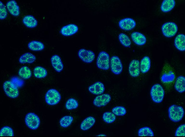 Methods - IFA - Automated process - Medipan & GA Generic Assays