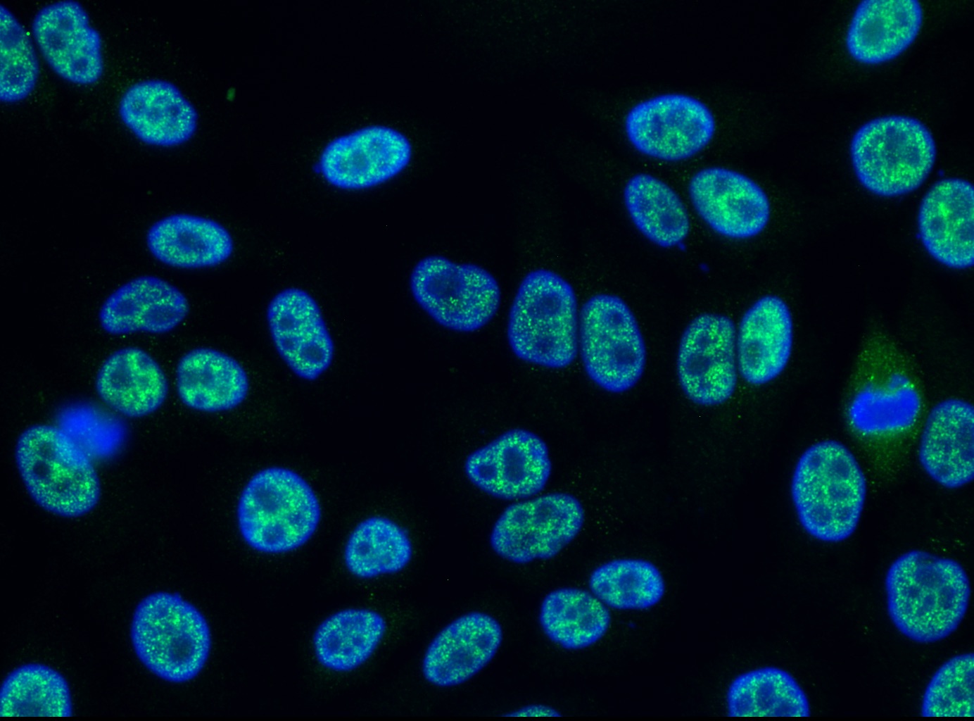 The image shows numerous cells with their nuclei stained in a bright blue color and other parts of the cells, likely specific proteins or structures, stained in a vibrant green fluorescence against a dark, black background. The cells have a speckled or granular appearance within their nuclei. The image is a typical representation of immunofluorescence microscopy.