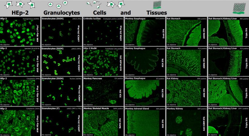 This image is a scientific collage showing a grid view of microscopic images. It depicts various cell types and tissues that have been stained using a technique called immunofluorescence. The bright green patterns show antibody binding, a method used in medical diagnostics.