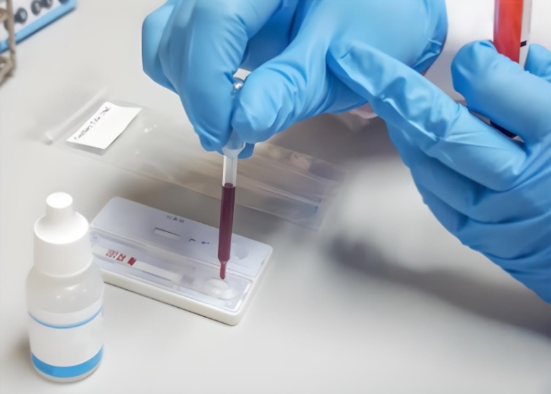 This is a close-up shot of a rapid diagnostic test, likely for a medical condition, being performed in a clinical or laboratory setting. A person wearing blue protective gloves is carefully using a dropper to apply a sample of red fluid, which appears to be blood, onto the sample well of a white test cassette. In the background, a small bottle of buffer solution and other laboratory supplies are visible. The scene captures a key step in a lateral flow assay procedure.