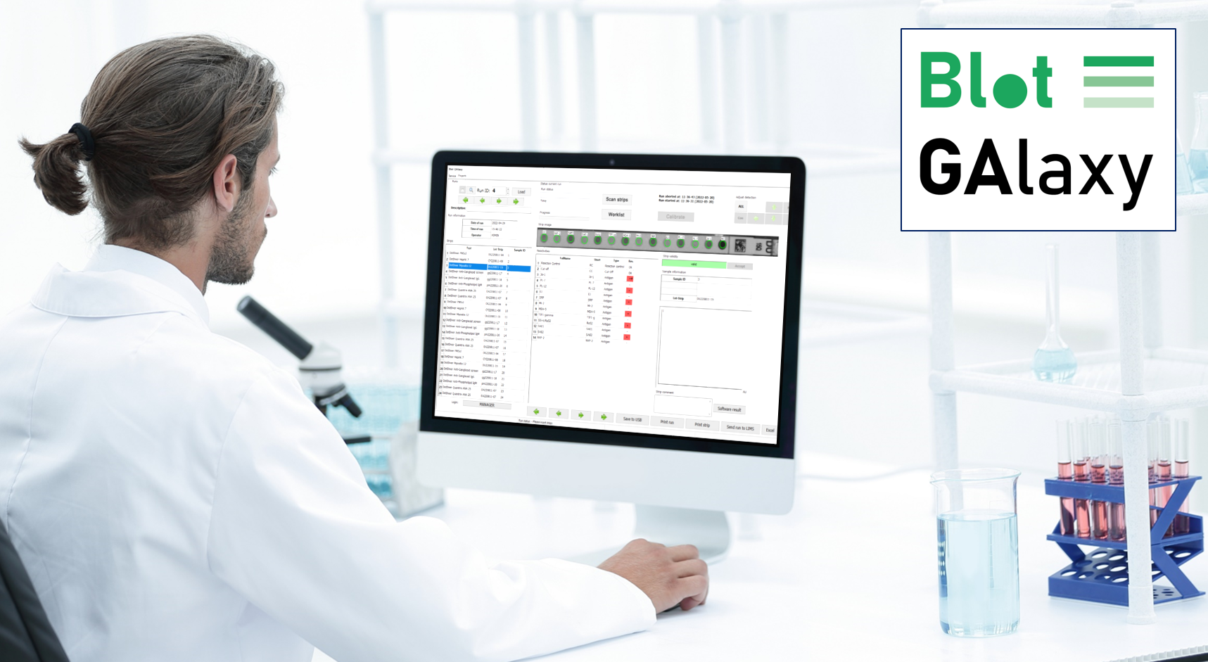 Blot GAlaxy: Advanced software for immunoblot analysis. Automated band detection, electronic archiving, and simultaneous analysis of up to 24 test strips. Perfect for diagnostic labs.