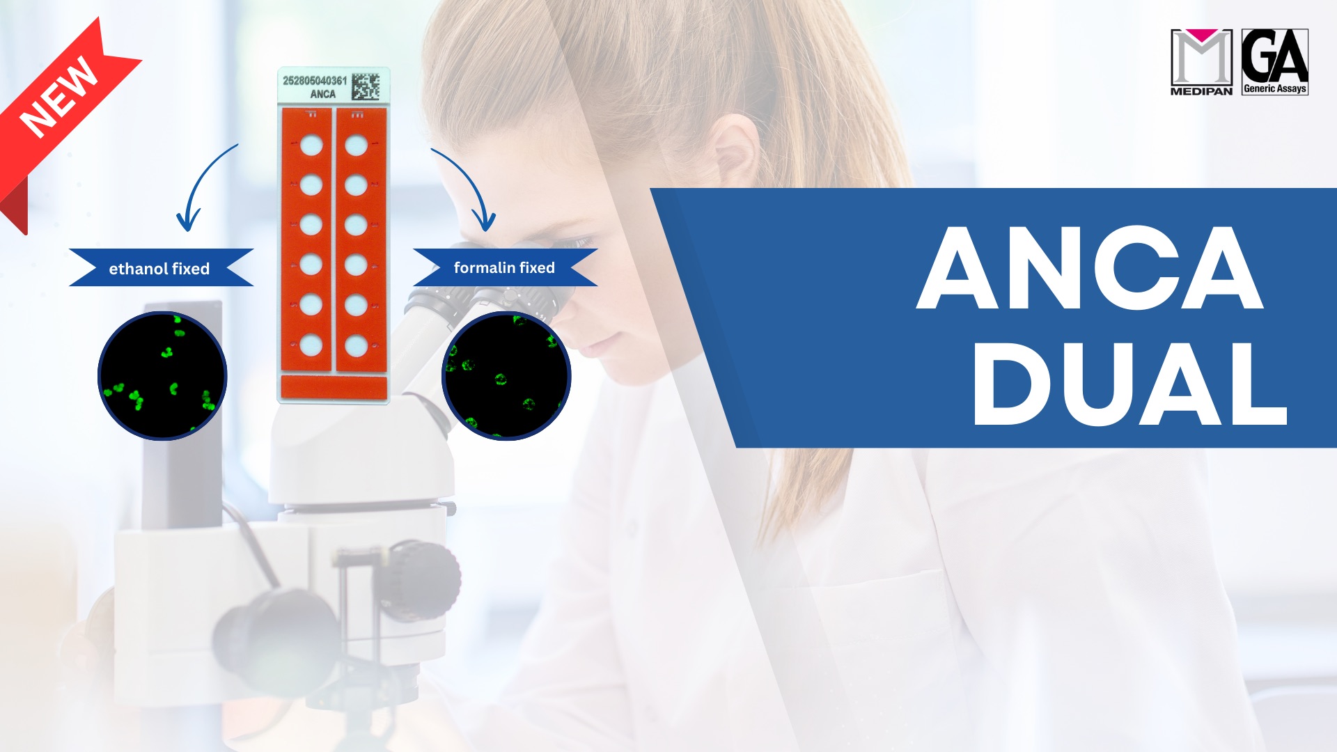 The picture shows a woman looking into a microscope. On the left side, there's a graphic of a test strip with multiple wells. Two arrows point to microscopic images showing the results of two different fixation methods: one for ethanol-fixed samples and one for formalin-fixed samples. The microscopic images show a green fluorescent pattern, which is characteristic of ANCA (anti-neutrophil cytoplasmic antibodies) testing.