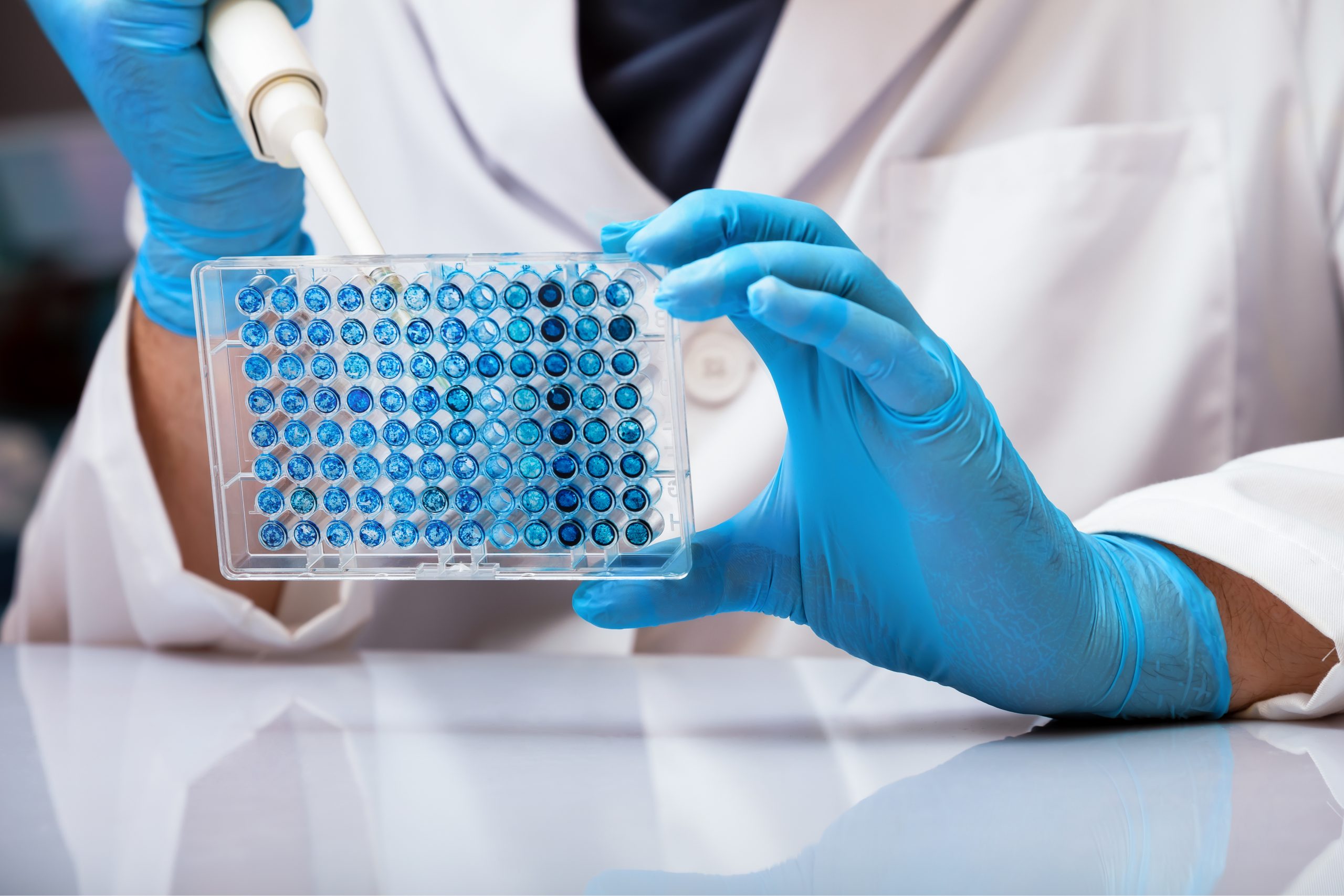 iologist pipetting samples in micro plate in the laboratory / Scientist in lab holding a 96 well plate with biological samples for analysis